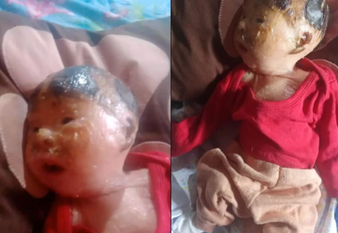 💔 Ele tem só 45 dias de vida. E já luta todos os dias para sobreviver à própria pele.