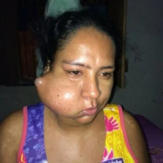 Ajude a Laura a lutar pela vida