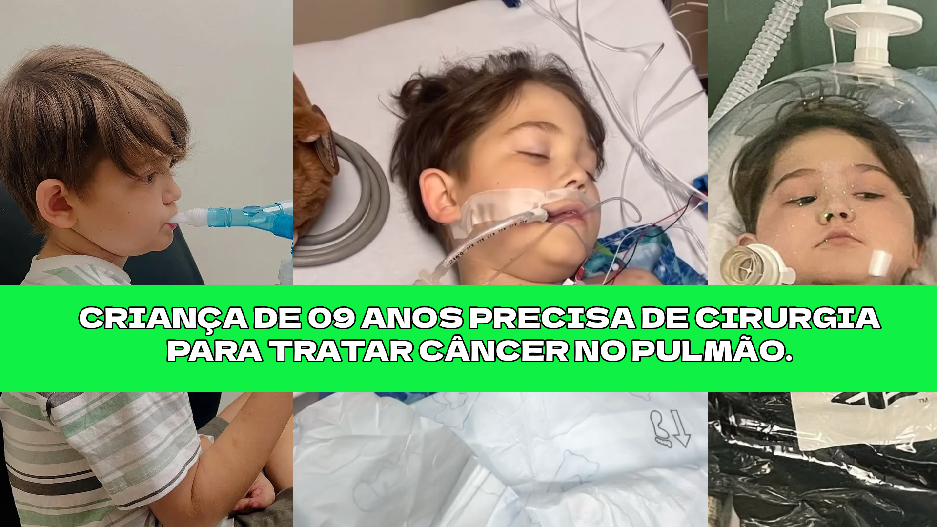 Miguel precisa de cirurgia para retirada de câncer no pulmão